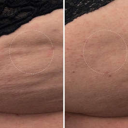 The Body Cream