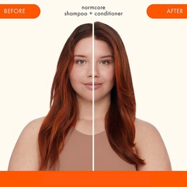 Normcore - Shampoo uden sulfater