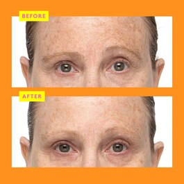 C-Firma™ Fresh Day Serum - C Vitamin Serum