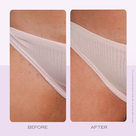 Ingrown Hair Pads - Rondeller til indgroede hår, 60 stk.