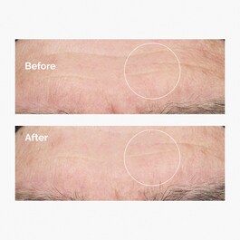 Hyaluronic Acid 2% + B5