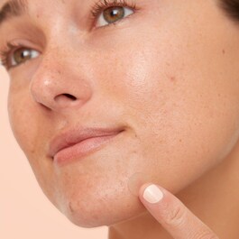 Acne Dots