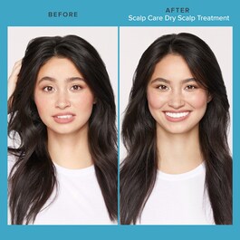 Scalp Care - Dry Scalp Treatment