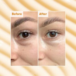 Brightening Dark Circle - Eye Cream