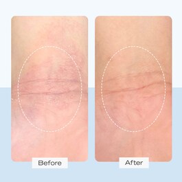 Ultra Repair - Cream