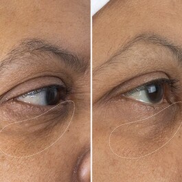 The Eye Cream Nomad