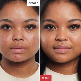 Super BB Au Ginseng - High coverage Anti-imperfections care