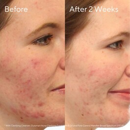 Clarifying - Cleanser