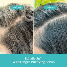 SahaScalp™ Scalp Reset Kit - Haircare kit