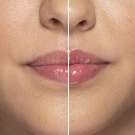 Lip Injection - Extreme Mini