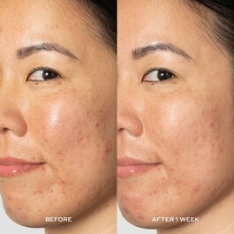 Glow2OH™ - Dark Spot Toner