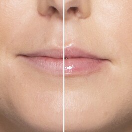 Lip Injection - Extreme Mini