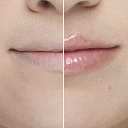 Lip Injection - Extreme Mini