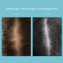 SahaScalp™ - Wild Ginger Purifying Scrub