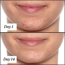 U.F.O. Mini - Ultra-Clarifying Face Oil