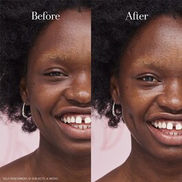 Rose Oil Serum - Fugtgivende olieserum med rose til ansigter
