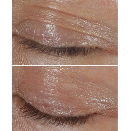 Smart Clinicial Repair - Wrinkle Correcting Eye Cream