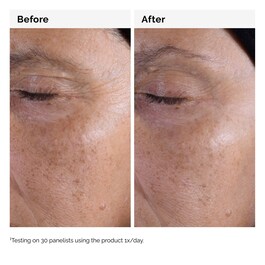 Glycolic Acid 7% - Toning Solution