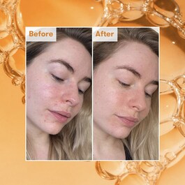 Ready Steady Glow - Daily AHA Tonic