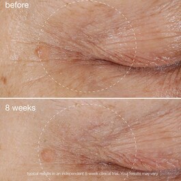 Biolumin-C Eye Serum - Vitamin C Radiance Booster
