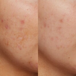 B3 Nice 10% Niacinamide - Radiance Serum