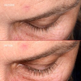 Lashbond™ - Øjenvippeserum