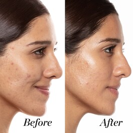 A+ High-Dose - Retinol Serum