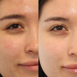 Oil and Pore Control - Mattifier SPF45