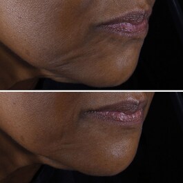 Smart Clinical Repair Micro Lift Cream