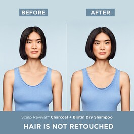 Scalp Revival™ - Charcoal + Biotin Dry Shampoo