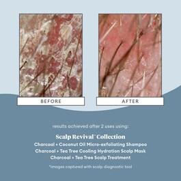 Scalp Revival™ - Micro-Exfoliating Shampoo
