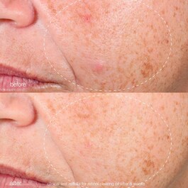 Retinol Clearing Oil