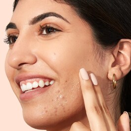 Face Blemishes - Acne Serum