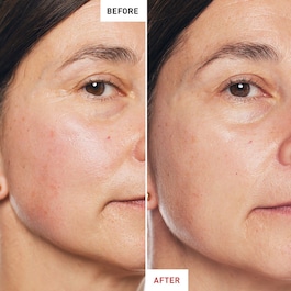 Skin Therapy  - Multi-Perfecting Night Oil