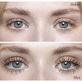 Lift + Light Eye Duo