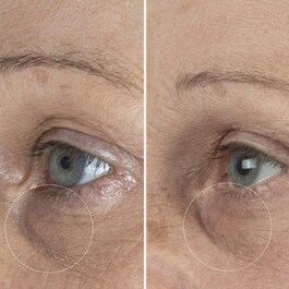 The Eye Cream Nomad