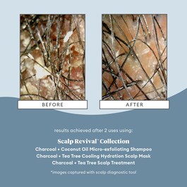 Scalp Revival™ - Micro-Exfoliating Shampoo