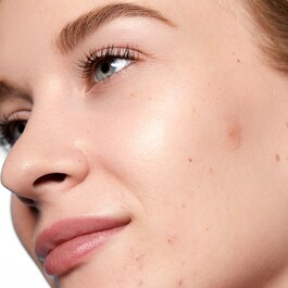 Acne Day Dot - Anti Acne Patches