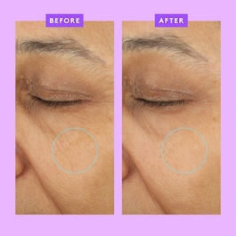 Ceramighty™ AF Eye Balm - Øjencreme Mod Mørke Rander