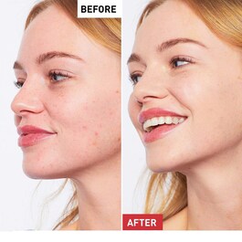 CC Red Correct