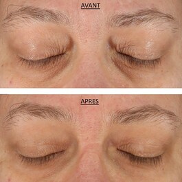 FAB-Skin Lab Retinol & Hyaluronic Acid Eye Cream