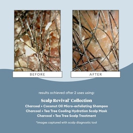 Scalp Revival™ - Micro-Exfoliating Shampoo