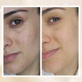 Overnight Glow - Dark Spot Sleeping Cream