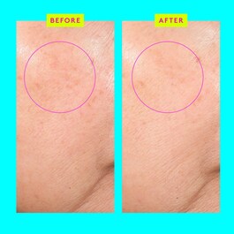 Bouncy Brightfacial™ - Clarifying face mask
