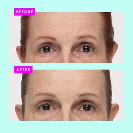 Protini™ Polypeptide Cream - Fugtgivende Ansigtscreme