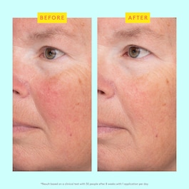 C-Luma™ Hydrabright Serum - Serum med C-vitamin