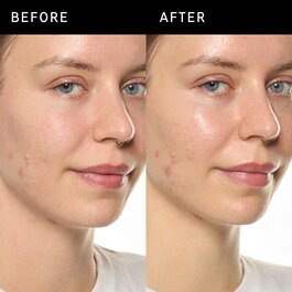 Ectoin Hydro-Barrier Serum - Fugtende og beskyttende serum