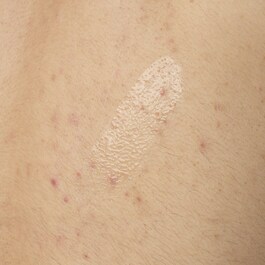 Kropsserum med 0,5 % salicylsure - Serum mod urenheder til kroppen
