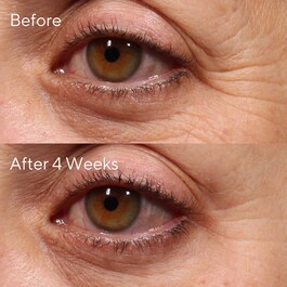 Retinol Youth Renewal Eye Serum